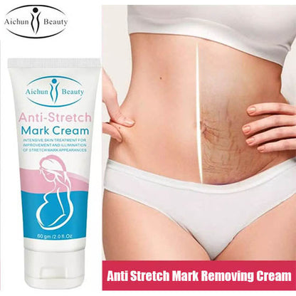 Anti-Stretch Mark Cream