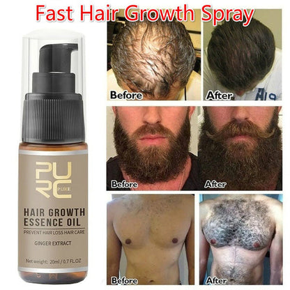 AUTHENTIC PURC HAIR GROWTH ESSENCE OIL