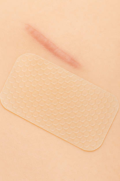 Silicone Scar Sheets – Fade Scars Fast & Flawlessly (2-Pack)