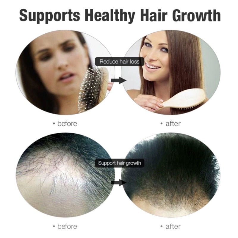 PURC Hair Growth Serum Fast Hair Growth Spray Hair & Scalp Treatments Anti Hair Loss