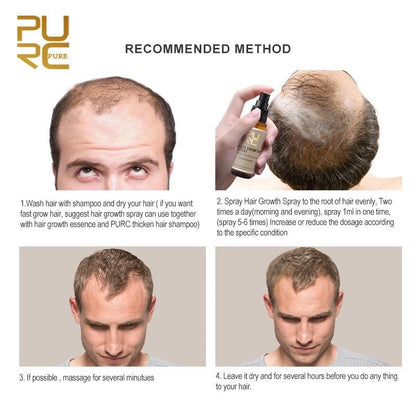 PURC Hair Growth Serum Fast Hair Growth Spray Hair & Scalp Treatments Anti Hair Loss