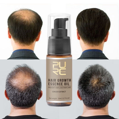 PURC Hair Growth Serum Fast Hair Growth Spray Hair & Scalp Treatments Anti Hair Loss